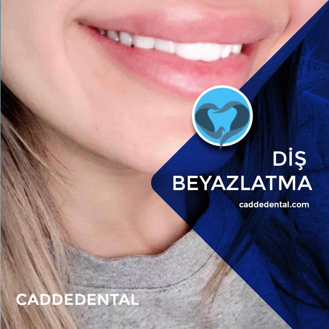 diş beyazlatma izmir cadde dental