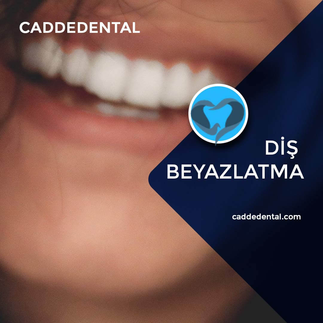 Bleaching işlemi