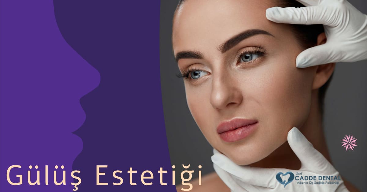 gülüş estetiği riskli midir